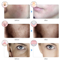 Load image into Gallery viewer, 7 Modes for Facial LED Masks For Mums'